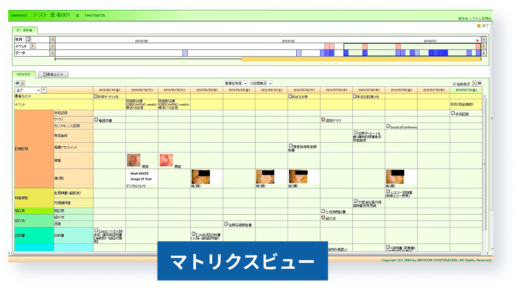 マトリクスビュー